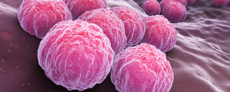 WCM-Q study reveals role of chlamydia infections in infertility among women in MENA region
