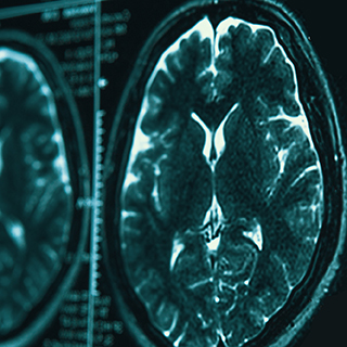 LIVE WEBINAR: Essentials of traumatic brain injury and long term effects